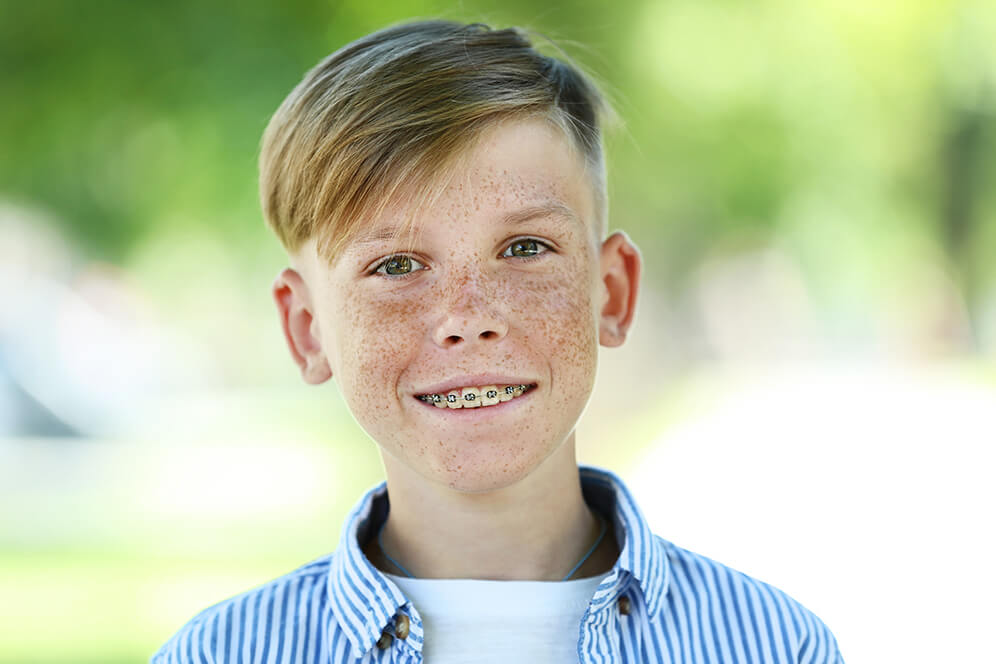 Junge trägt in jungen Jahren eine Zahnspange, um den Wachstum des Kiefers zu fördern und eine stabile Verzahnung herzustellen